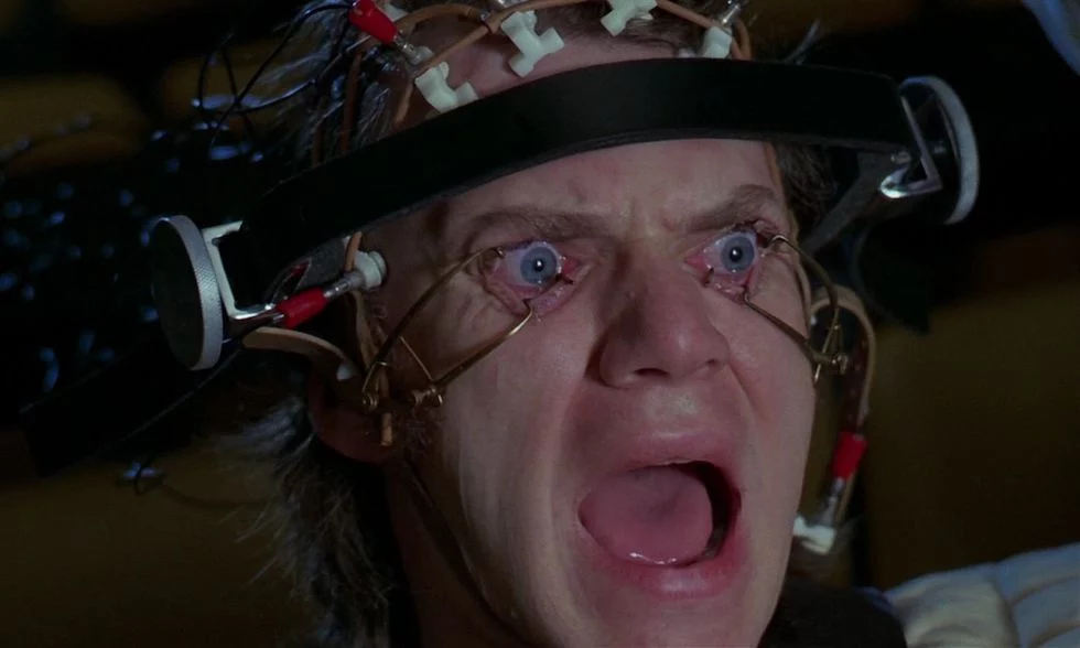 Malcolm Mcdowell En La Naranja Mecanica
