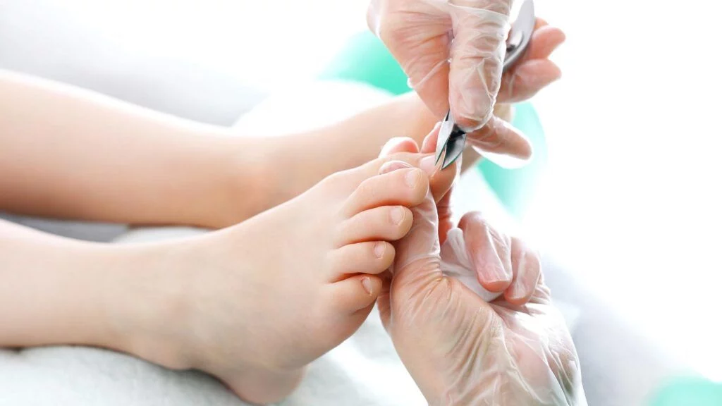 Corte correcto de las uñas
