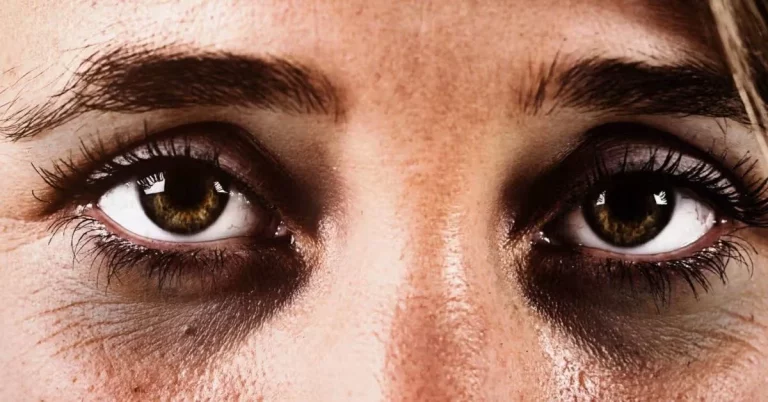 Soluciona las molestas ojeras con este contundente remedio casero