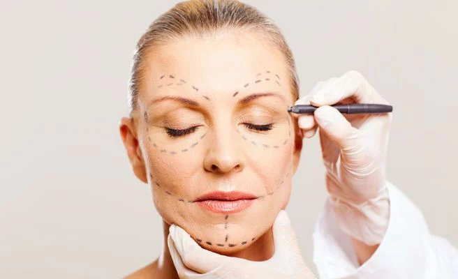 Blefaroplastia: rejuveneciendo la mirada