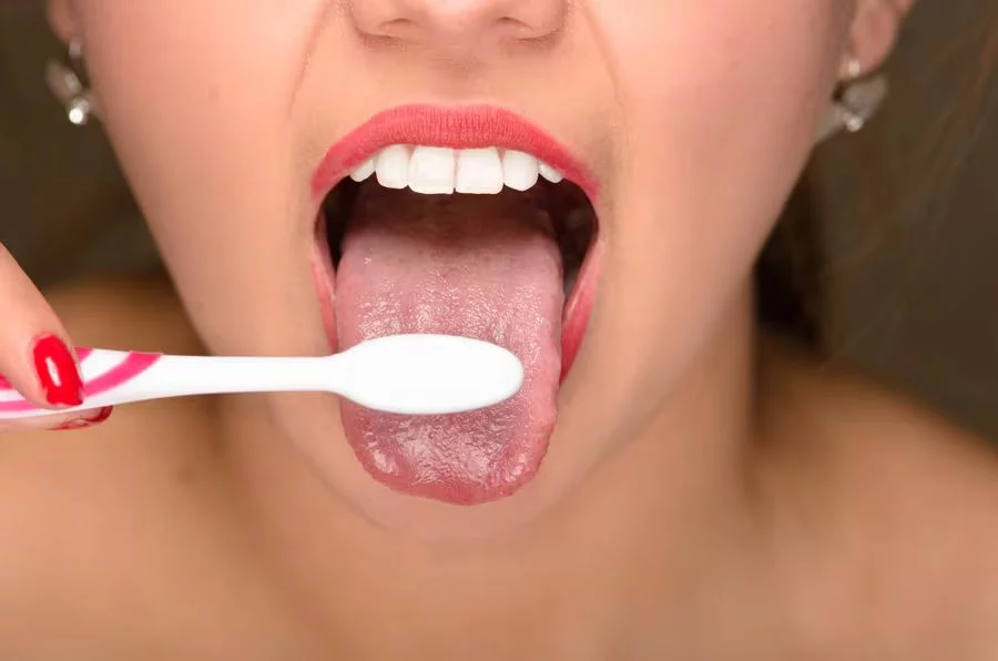 La lengua alberga bacterias y restos de alimentos