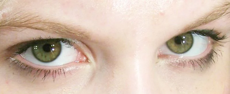 La Genética Detrás Del Color De Los Ojos