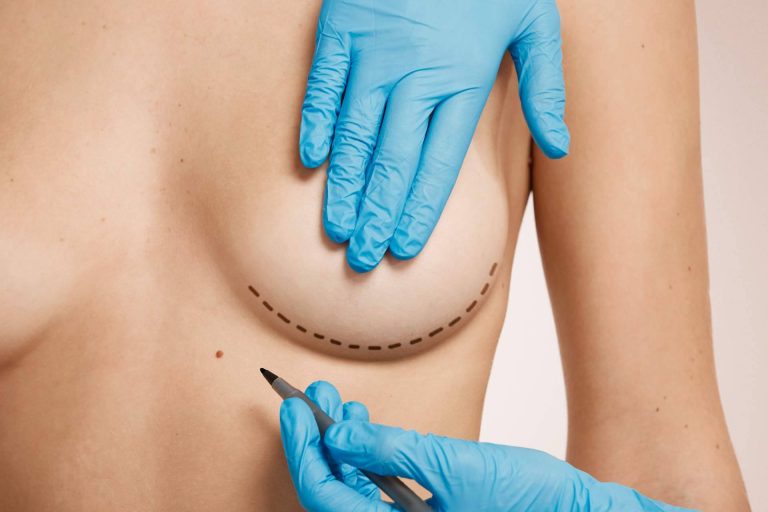 Cirugías preverano; en busca de la armonía facial y corporal