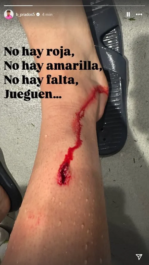 Publicación De Beñat Prados En Instagram. Fuente: Instagram (@B_Prados5)