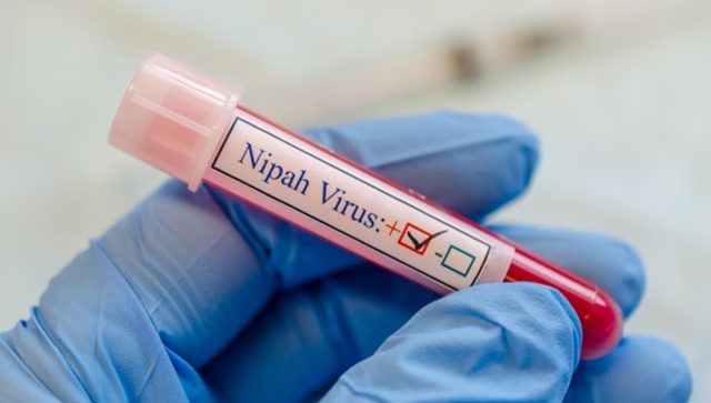 La Oms Vigila El Virus Nipah Como Posible Pandemia Tras Matar Ya A Un Joven