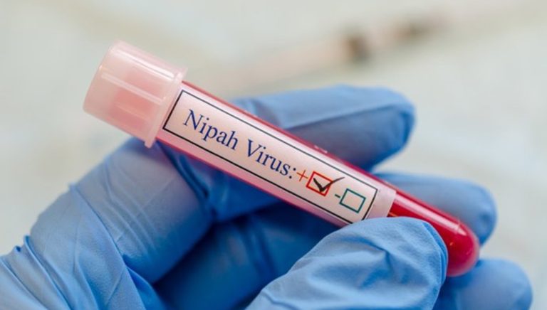 La OMS vigila el virus Nipah como posible pandemia tras matar ya a una joven
