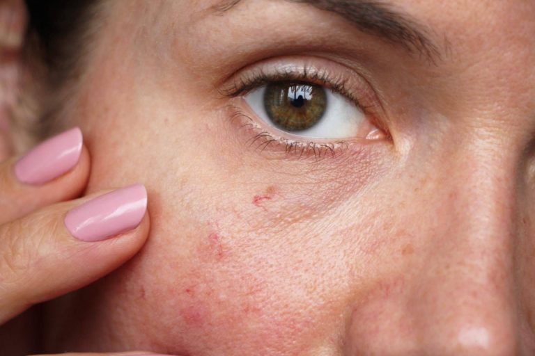 Evoderm, dermocosmética avanzada para el cuidado de la piel con fórmulas limpias, efectivas y avaladas por expertos
