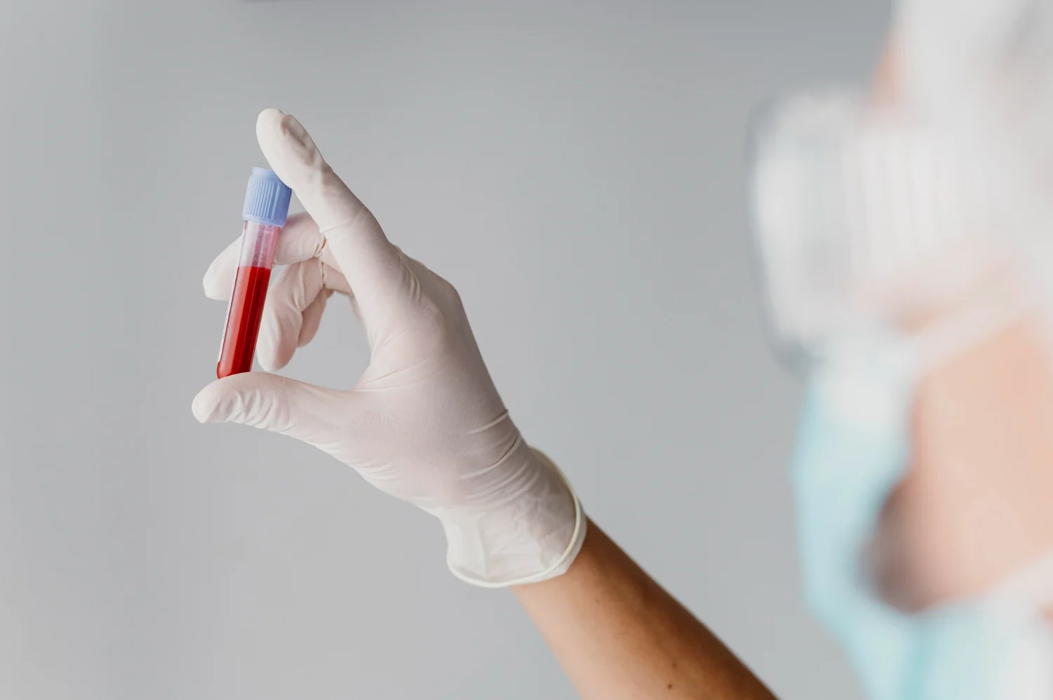 José Iruttia (52), Médico, Nos Cuenta Cada Cuánto Tiempo Hay Que Hacerse Un Análisis De Sangre: &Quot;Lo De Una Vez Por Año Es Un Mito, Te Lo Tienes Que Hacer Cada...&Quot; 2 Si Estás En La Veintena, No Tienes Patologías Y Llevas Un Estilo De Vida Saludable, La Recomendación Cambia Radicalmente.