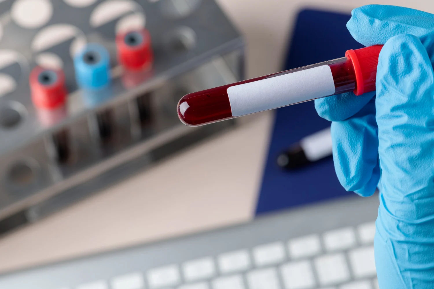 José Iruttia (52), Médico, Nos Cuenta Cada Cuánto Tiempo Hay Que Hacerse Un Análisis De Sangre: &Quot;Lo De Una Vez Por Año Es Un Mito, Te Lo Tienes Que Hacer Cada...&Quot; 1 La Idea De Una Revisión Fija Para Todos Choca De Frente Con La Medicina Personalizada Del Siglo Xxi.
