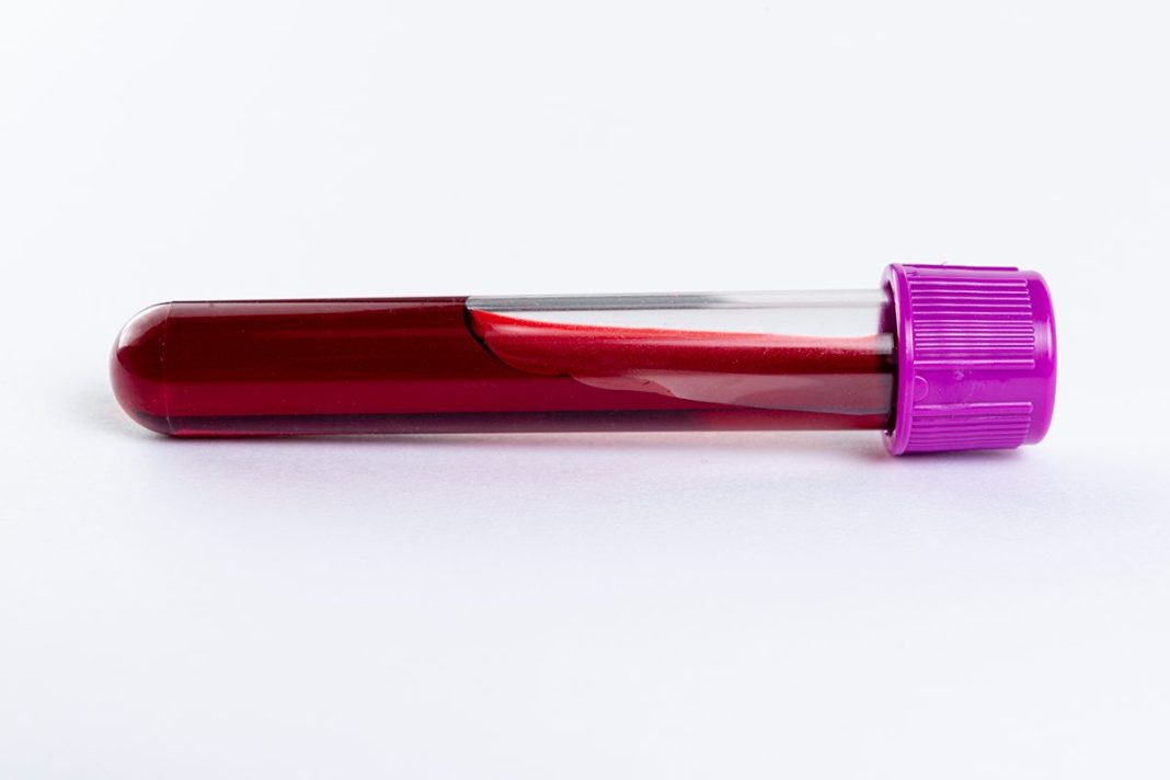 LA GRAN VENTAJA DE LA SANGRE ARTIFICIAL EN POLVO